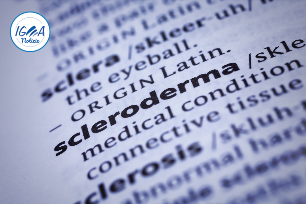 Sclerodermia. Cos’è, sintomi, diagnosi