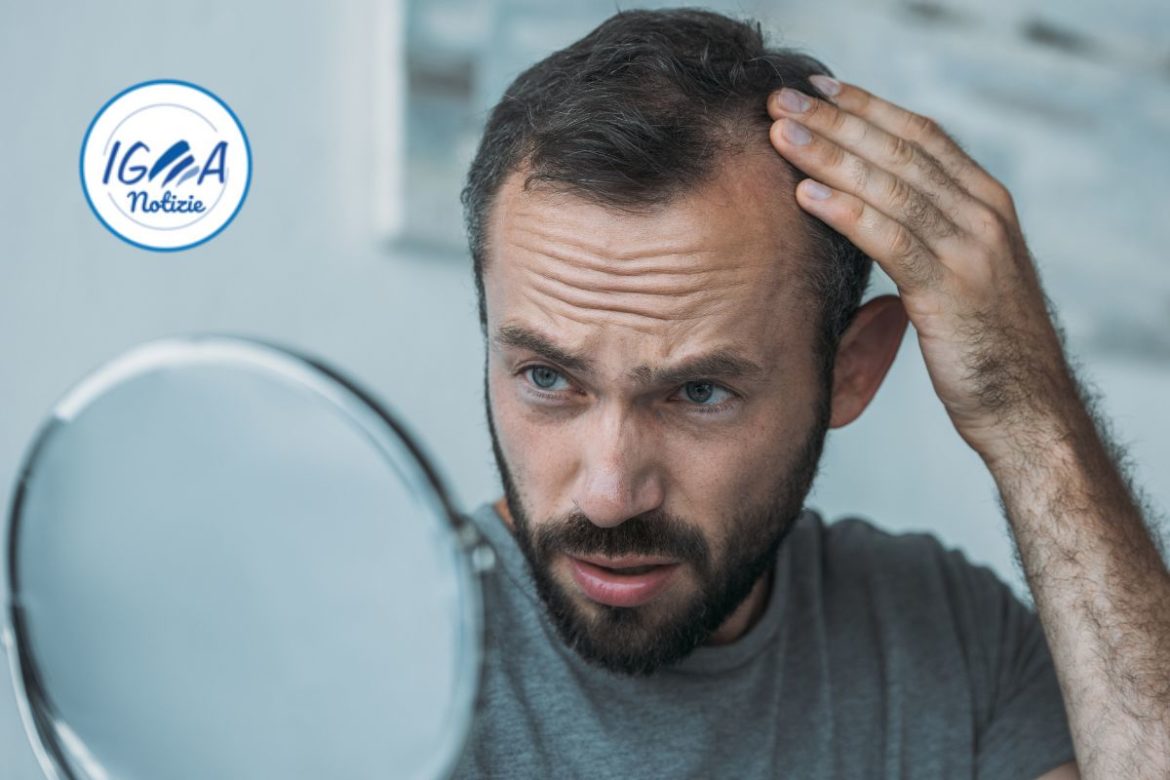 Caduta dei capelli: cause, esami e trattamenti
