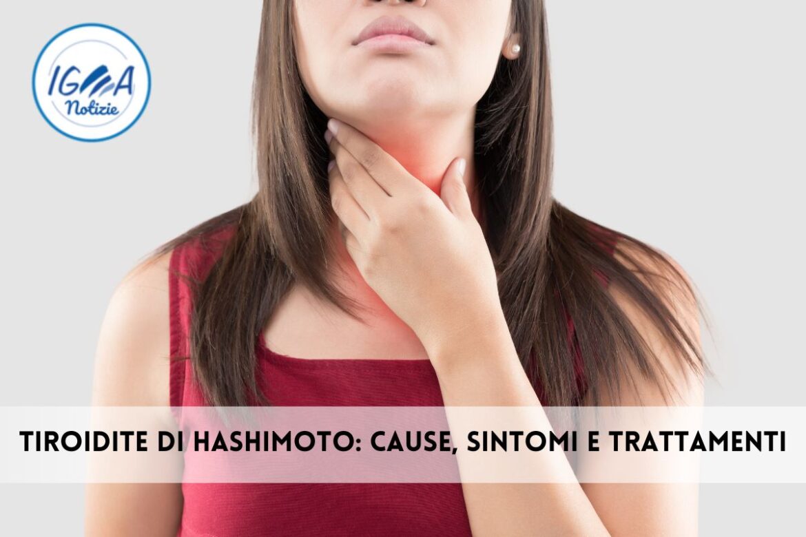 Tiroidite di Hashimoto: cause, sintomi e trattamenti